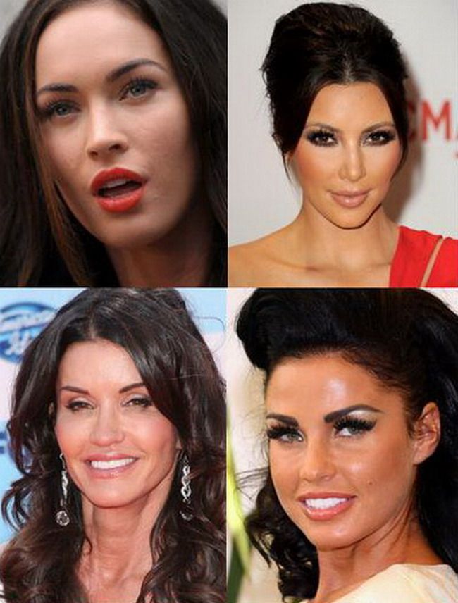Celebritati care au pierdut din expresivitatea faciala din cauza Botoxului GALERIE FOTO