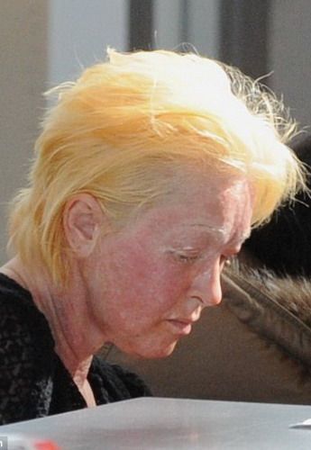 Cindy Lauper, imaginea cosmeticelor MAC, cu fața distrusa! FOTO