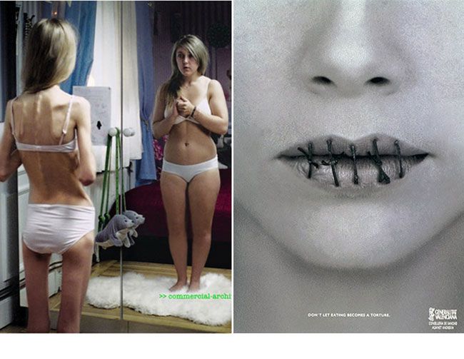 Cele mai socante campanii anti-anorexie