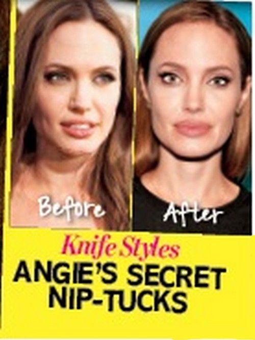 Imaginile care sugereaza ca Angelina si-a facut operatii estetice recent, pentru a pacali trecerea timpului. Cum arata vedeta inainte si dupa