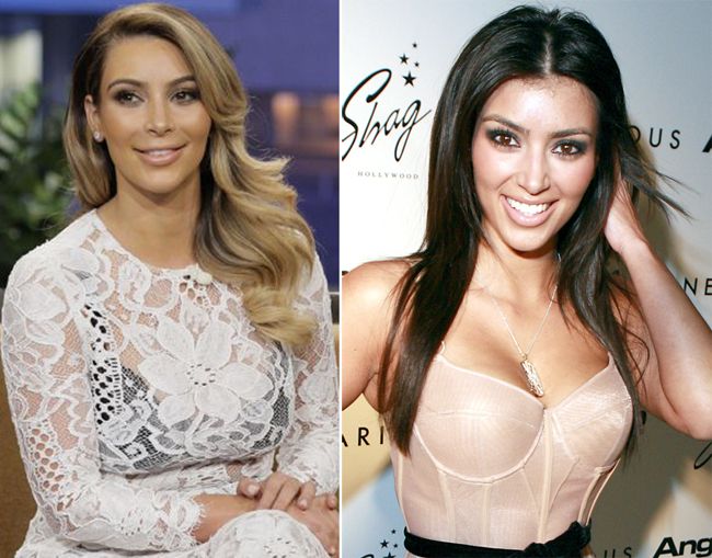 Ce si-a facut Kim Kardashian la fata?! Dovada clara ca starleta de reality show isi deformeaza chipul cu operatii estetice VIDEO