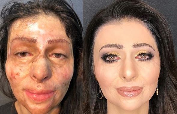 Un make-up artist din Azerbaijan face minuni pentru femeile arse cu acid. Cum arata tinerele dupa ce sunt machiate de el